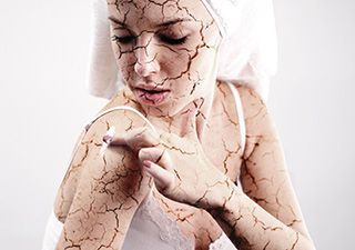 Psoriasis: Hautkrankheit mit vielen Gesichtern
